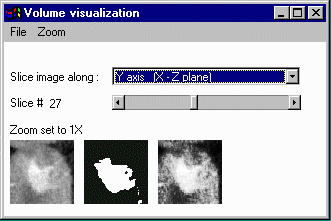 slice along Y-axis